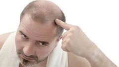 قريباً..."حبة دواء" تقضي على الصلع والشيب!