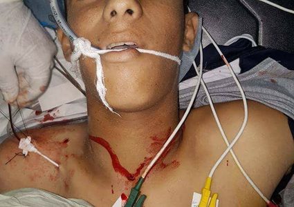 استشهاد طفل متأثرا بجراحه في غزة