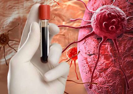 ابتكار مستحضر آمن وفعال لعلاج السرطان