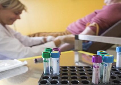 فحص دم يجنب المصابين بسرطان البروستاتا الكيماوي