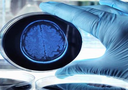 إنشاء مادة كيميائية كالغراء تمنع الإصابة بالزهايمر