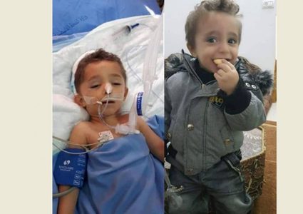 وفاة طفل متأثراً بإصابته بعد وقوع تلفاز عليه بجنين