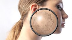 أسباب تسمم البشرة ووصفات لعلاجها