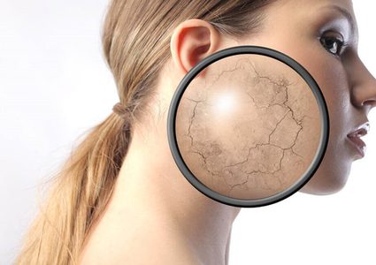 أسباب تسمم البشرة ووصفات لعلاجها