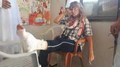 إصابات برصاص الاحتلال في كفر قدوم