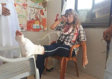 إصابات برصاص الاحتلال في كفر قدوم