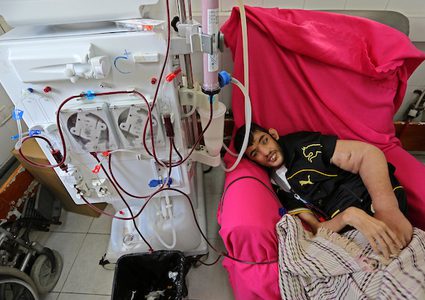 خلال أزمة الكهرباء..مرضى غزة يخضعون لغسيل الكلى
