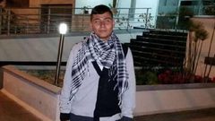 شاب يبتر أنفه ويقطع أذنيه لسبب خاص!