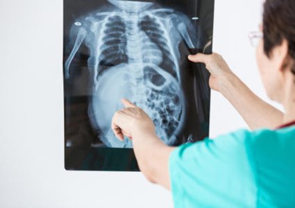 ما هي أنواع وأعراض مرض سرطان العظام؟