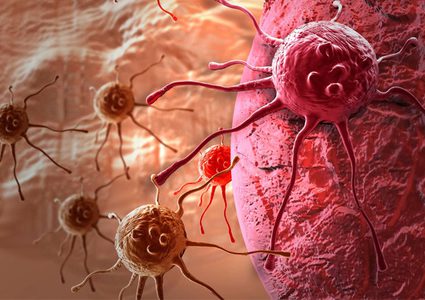 أعراض السرطان التي تظهر قبل خمس سنوات من المرض