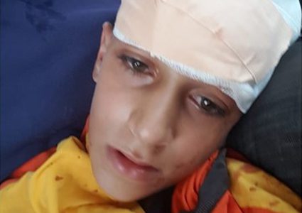 اصابة طفل برصاص الاحتلال في كفر قدوم