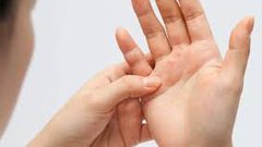 كيف تتعاملين مع حساسية الجلد "الاكزيما"؟