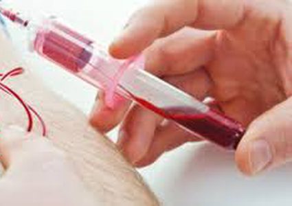 دراسة: دم الشباب يشفي أمراض الشيخوخة !