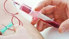 دراسة: دم الشباب يشفي أمراض الشيخوخة !