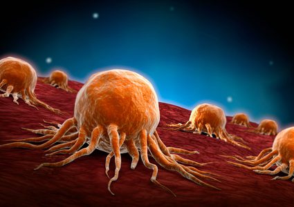 علامات الإصابة بالسرطان