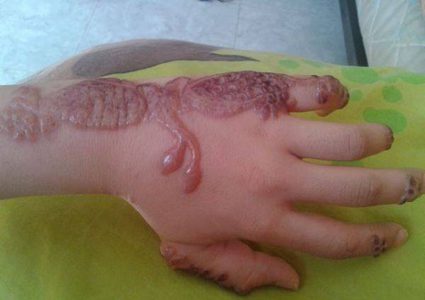 فتيات تحولت فرحتهن إلى مأساة فما السبب ؟