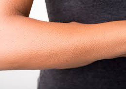 القشعريرة .. ما علاقتها بالسعادة والصحة ؟