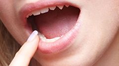 ماذا يقول لسانك عن صحتك؟