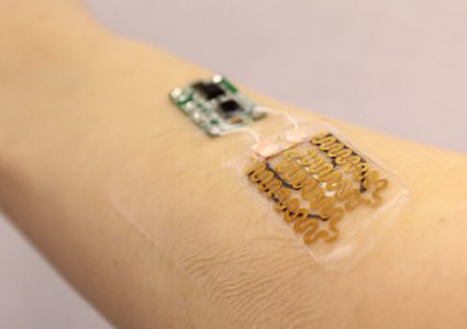 ضمادات ذكية لشفاء الجروح المزمنة