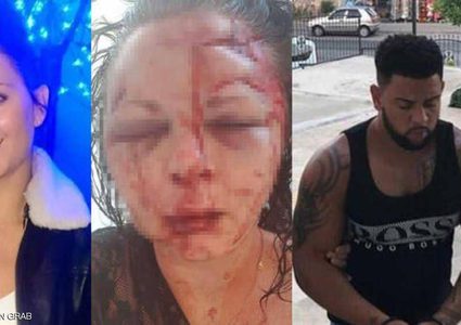 "اعتداء وحشي" يبدل ملامح شابة بريطانية في تركيا