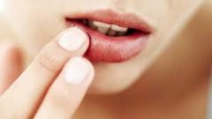 تقرحات الفم.. الأسباب وطرق الوقاية والعلاج