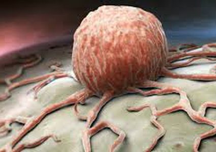 دراسة: سبب "صادم" وراء الإصابة بسرطان القولون!