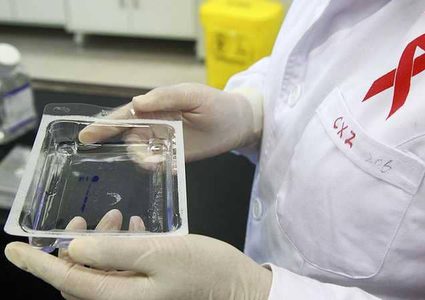 "منتج طبيعي" يحدث ثورة في علاج الإيدز