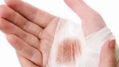 ابتكار رغوة خاصة لغلق جروح الأعيرة النارية