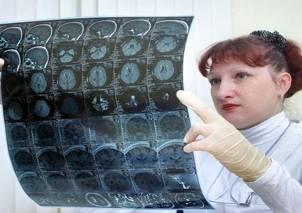 طريقة بسيطة لتحسين الذاكرة