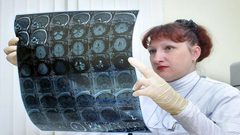 طريقة بسيطة لتحسين الذاكرة