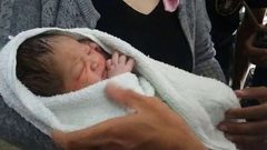 "الموز" ينقذ مولودة حديثة من الموت !