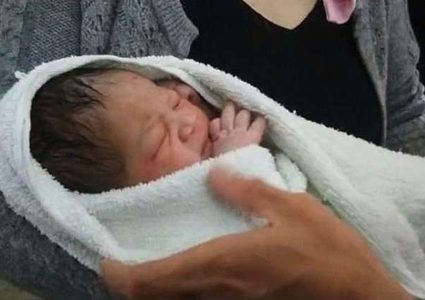 "الموز" ينقذ مولودة حديثة من الموت !