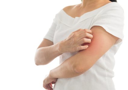 لتخفيف أعراض الصدفية.. إليك بالطب البديل