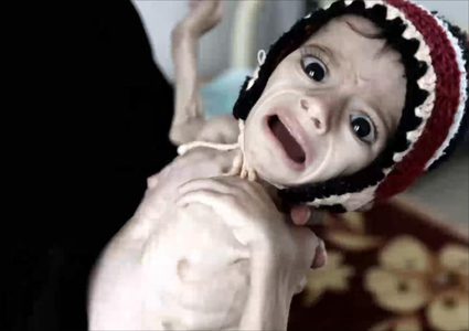 استمرار حرب اليمن يهدد بأسوأ مجاعة منذ 100 عام