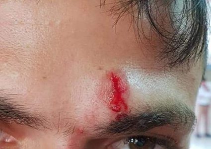 إصابتان في اعتداءات مستوطنين قرب بزاريا شمال نابلس