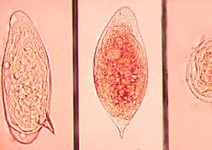 مرض البلهارسيا، تعريفه، أسبابه، أعراضه، والعلاج!