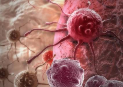 عقار جديد يخفض فرص عودة سرطان خطير للغاية