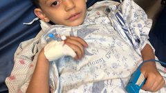 انقاذ حياة طفل اصيب بمسمار مسدس تنجيد بمنجرة