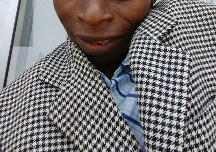 قصة رجل يعاني من حالة نادرة تحوله إلى حجر