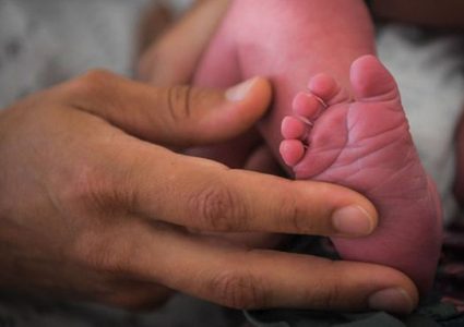 انتشار ولادة أطفال "بلا أطراف" في فرنسا!