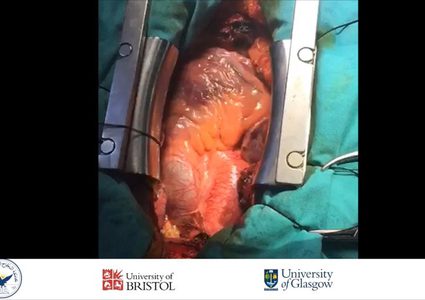 جراحون يجرون إحدى العمليات النادرة بالعالم