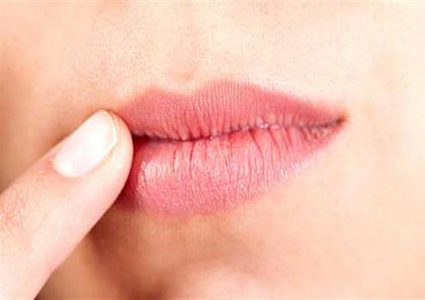 مكوّنات طبيعيّة تخلصك من تشقّق الشفاه