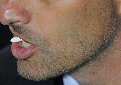 مخاطر الاستمرار في مضع العلكة