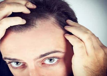 ما هي العلاقة بين تساقط الشعر و الغدة الدرقية؟