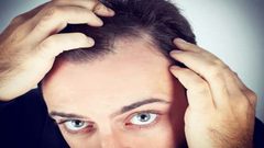 ما هي العلاقة بين تساقط الشعر و الغدة الدرقية؟