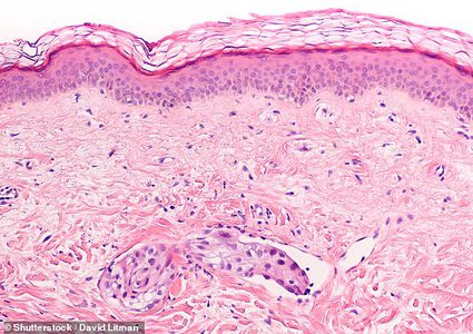 الفحص المبكر يقلل خطر الإصابة بسرطان الثدي