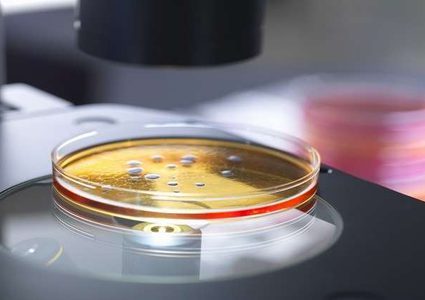 ما الذي سيقتل أكثر من مليوني شخص في الغرب