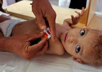 بريطانيا تقدم مشروع قرار لمجلس الأمن حول اليمن