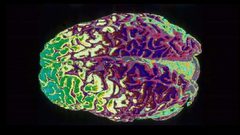 اكتشاف مادة تطيل ريعان "الشباب" للدماغ