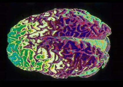 اكتشاف مادة تطيل ريعان "الشباب" للدماغ